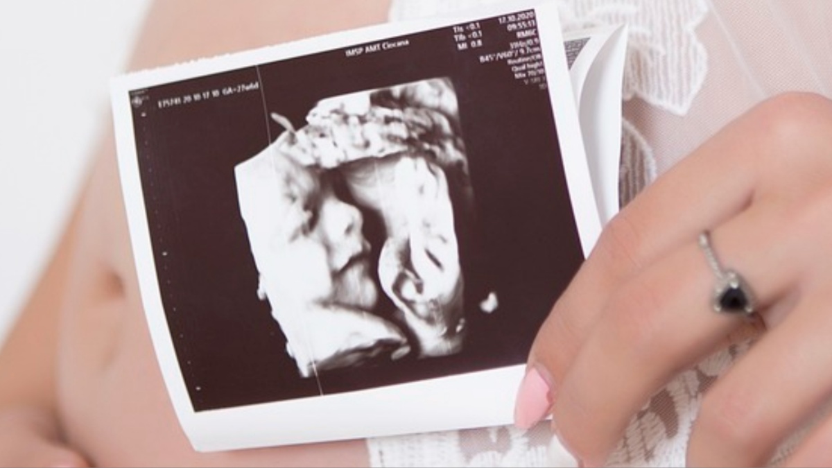 A sonogram.