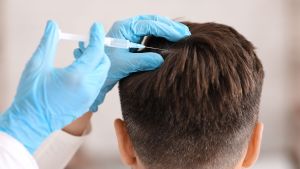 Joel McHale hair transplant