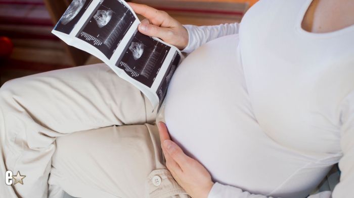 A pregnant woman