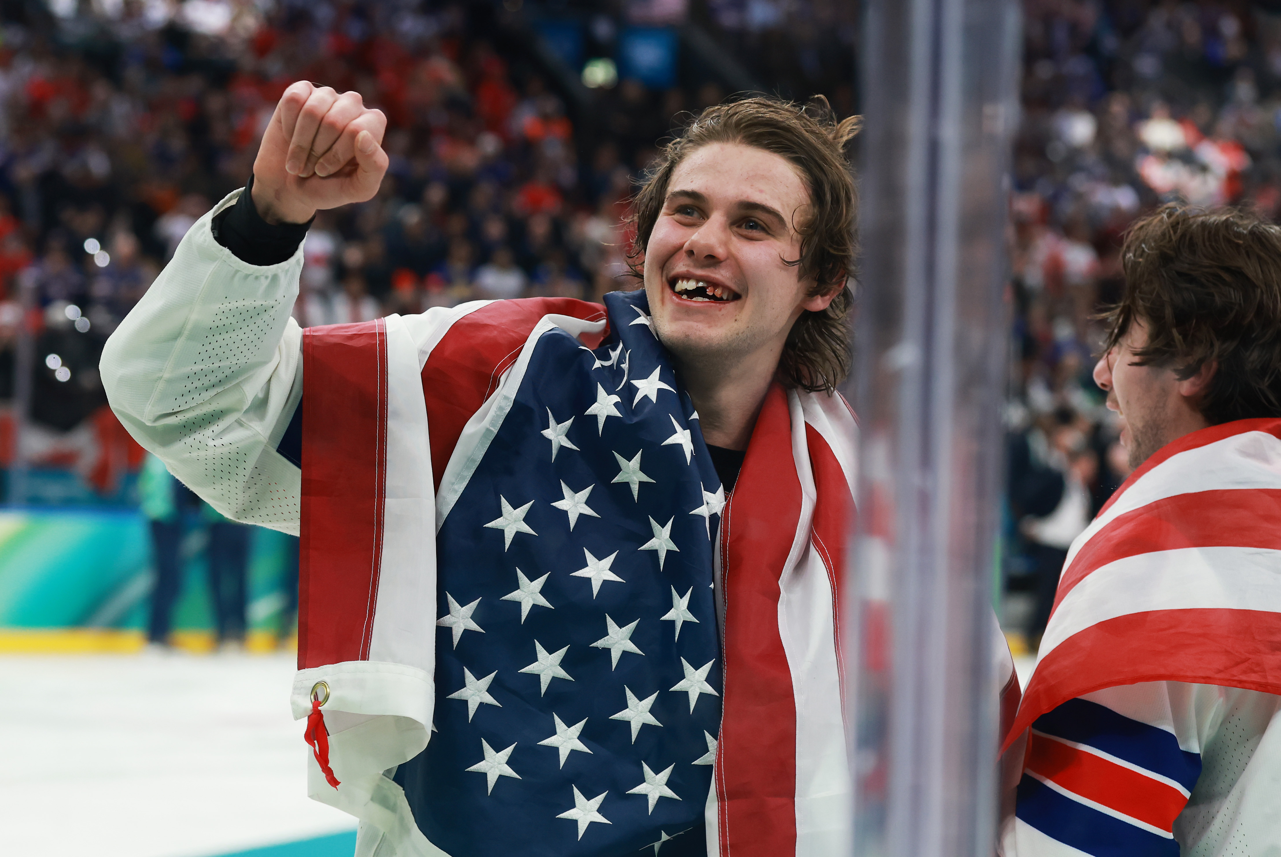 What Happened to Jack Hughes Teeth? Hockey Star Injured in Gold Medal Game
