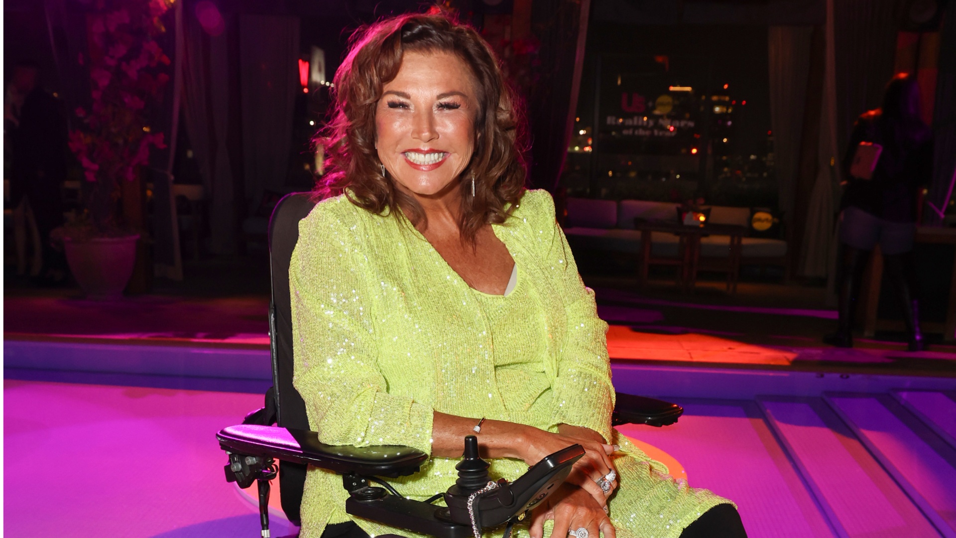Abby Lee Miller se gaba de novo procedimento cosmético ‘incrível’